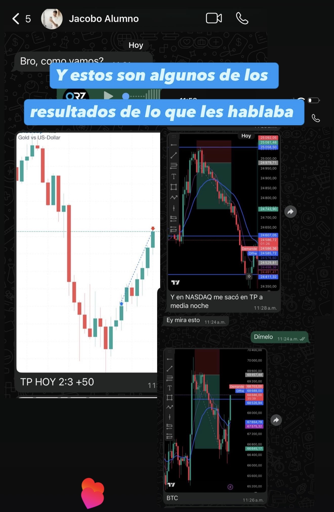 Trade XAUUSD +$125 de @_juandajimenezz
